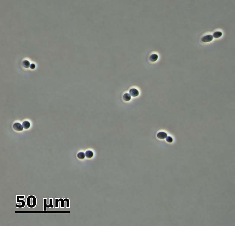 Bright-field micrograph of a budding-yeast preparation: budding pairs and isolated cells coexist; scale bar 50 µm.